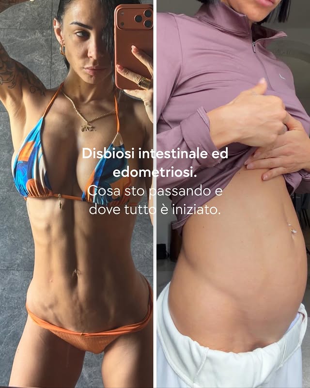 .La mia storia. La mia esperienza.Le mie sfide. La mia crescita.Sperando che questo video possa essere di aiuto a qualcuno, non per subire quello che le sta accadendo ma per reagire e non tollerare delle condizioni di disagio e difficoltà che queste patologie e disturbi inevitabilmente portano.Cerchiamo la soluzione. Ancora una volta, INSIEME 🖤 Nuovo video in app 📲 @sgprogram #endometriosi #disbiosiintestinale #abitudini #gonfioreaddominale by @selenegenisella