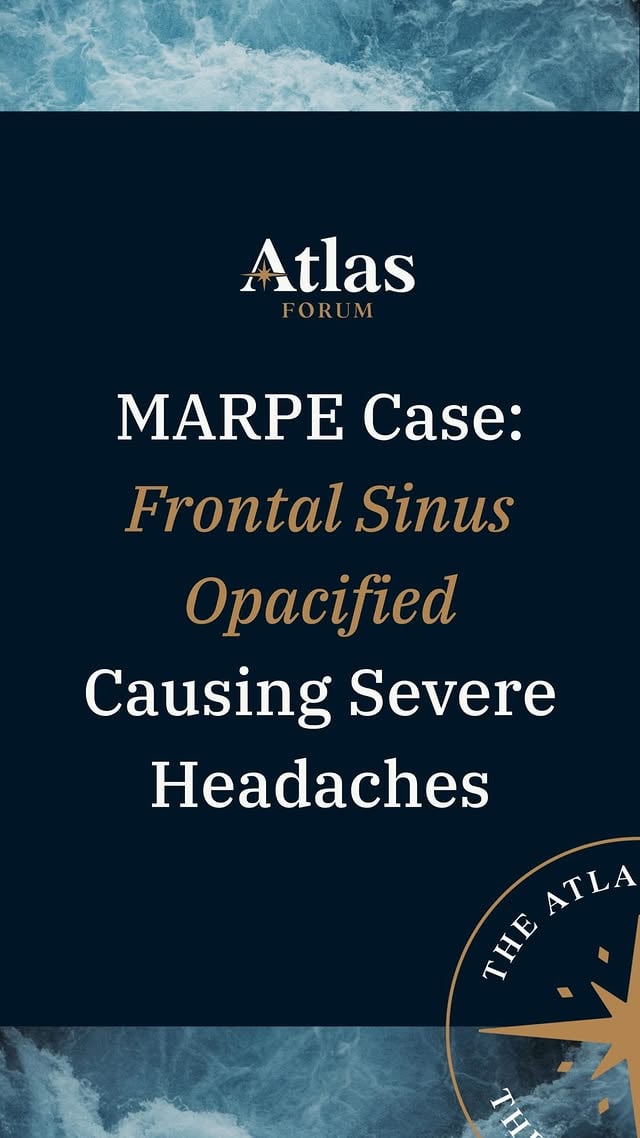 This is why CBCT review matters.During our first Atlas webinar, Dr. Nick Colvin of Carolina OMF Imaging walked through a MARPE case where the appliance side looked strong — but the scan revealed a much bigger clinical picture, including a significantly narrow airway and frontal sinus opacification associated with severe headaches.That’s the point of Atlas.Not just more information. Better clinical discussion.Diagnosis, radiology, airway, appliance design, and treatment planning all have to come together if we want better decisions before treatment begins.#AtlasForum #MARPE #CBCT #Orthodontics #SkeletalExpansion by @odlortholab