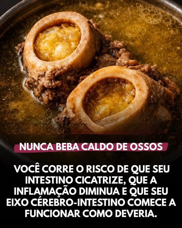 🍖 Você já ouviu que o problema era comer “comida de verdade”… mas muitas vezes o verdadeiro problema era ter medo de comer!O caldo de ossos, a carne vermelha de qualidade, a gordura natural dos animais, o sal sem processar e as vísceras bem preparadas fazem parte da alimentação humana há gerações. Eles não são inimigos, mas sim aliados quando usados com equilíbrio e inteligência.🔹 Proteína completa para fortalecer músculos e reparar o corpo.🔹 Ferro, zinco e B12 para dar energia, melhorar o desempenho e cuidar da saúde hormonal.🔹 Gorduras naturais que ajudam a sentir saciedade e manter os hormônios funcionando bem.🔹 Minerais importantes para hidratação, músculos e nervos saudáveis.🔹 Colágeno e gelatina presentes nos caldos, que ajudam dentro de uma dieta variada.O erro de hoje não é comer esses alimentos… muitas vezes é viver parado, dormir mal, comer ultraprocessados e culpar o básico.Não precisa de extremos. Precisa de critério.Comida de verdade + treino inteligente + constância = corpo que responde 💪 by @emagrecer.com.receitas